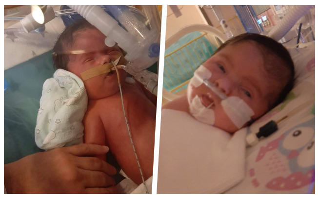 Pomóżmy małej Helence z Kobylnicy! 2 Portal Swarzedzki pomozmy Helence 00