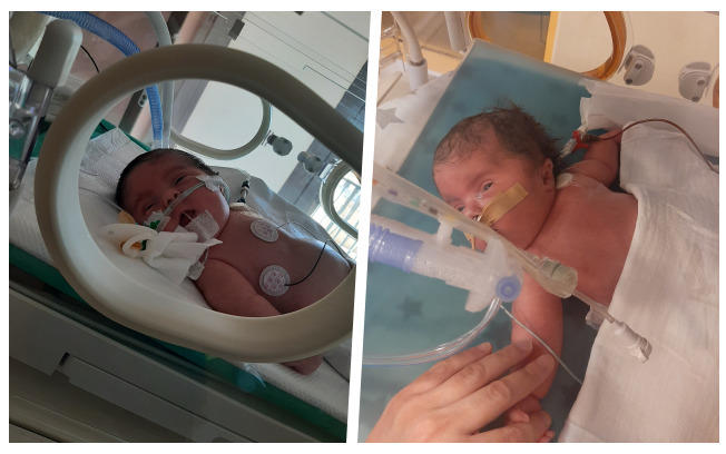 Pomóżmy małej Helence z Kobylnicy! 4 Portal Swarzedzki pomozmy Helence 01