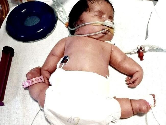 Pomóżmy małej Helence z Kobylnicy! 3 Portal Swarzedzki pomozmy Helence 02